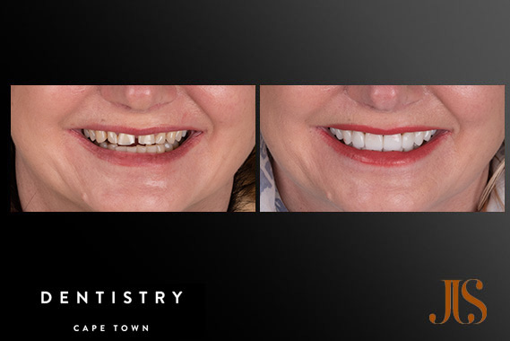 Cosmetic Dentistry