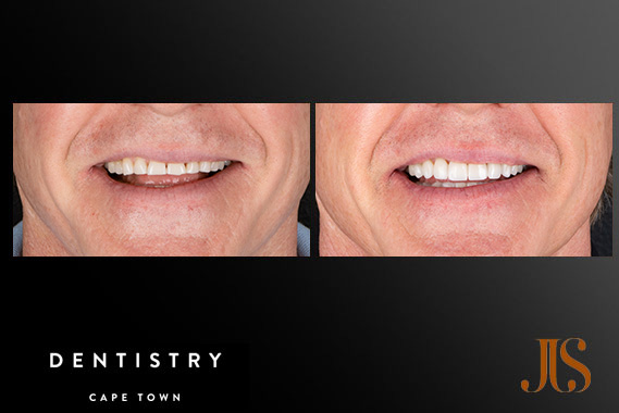 Cosmetic Dentistry