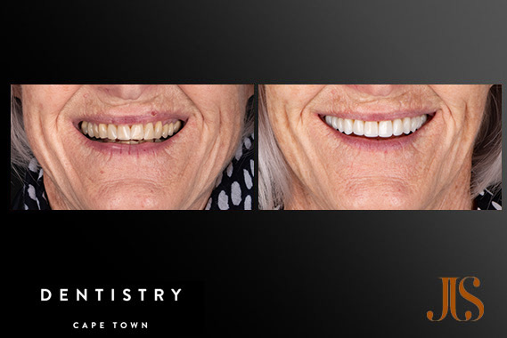 Cosmetic Dentistry