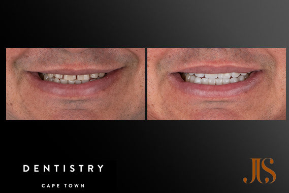 Cosmetic Dentistry