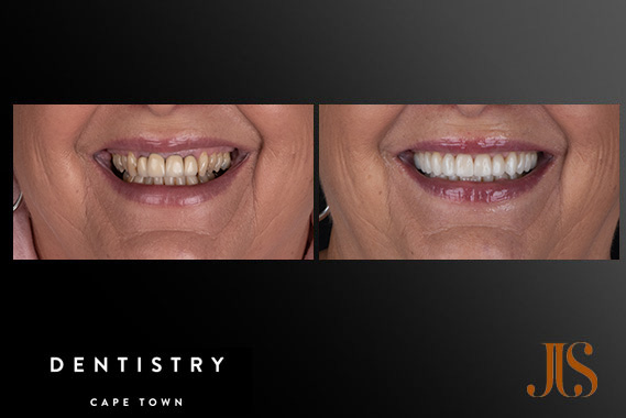 Cosmetic Dentistry