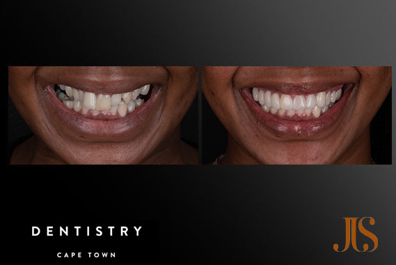 Cosmetic Dentistry