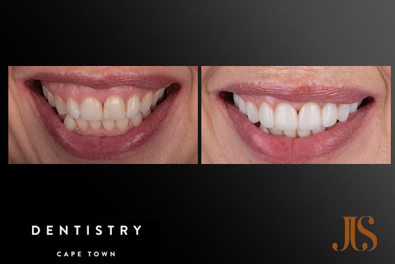 Cosmetic Dentistry