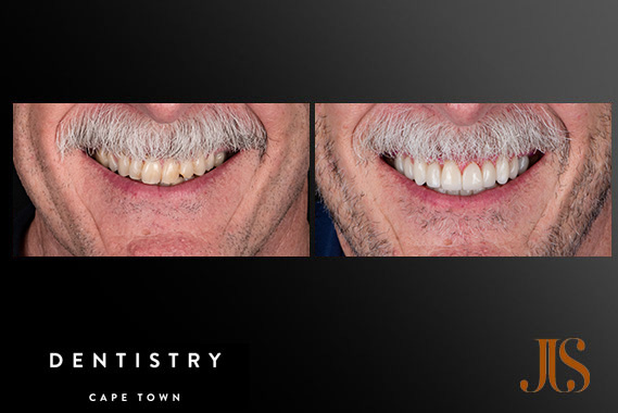 Cosmetic Dentistry