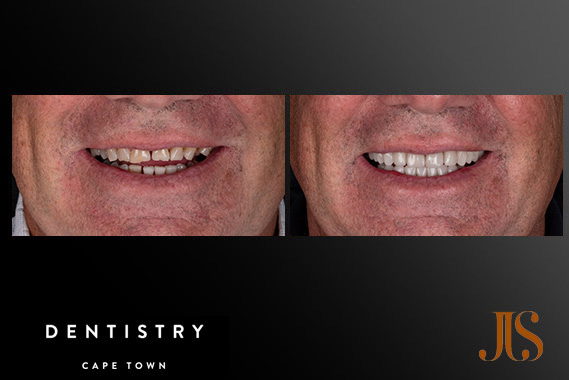 Cosmetic Dentistry