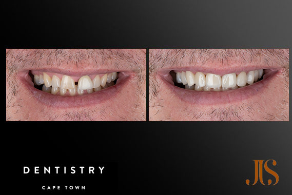 Cosmetic Dentistry