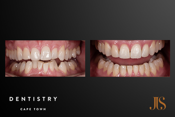 Cape Town Orthodontics