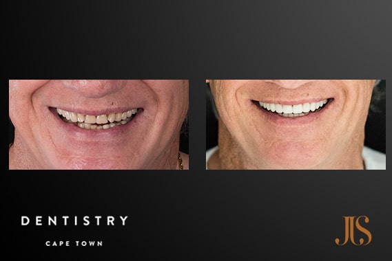 Comprehensive Reconstruction | Dr JJ Serfontein