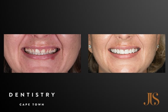 Comprehensive Reconstruction