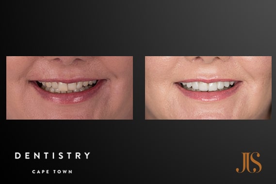 Comprehensive Reconstruction | Dr JJ Serfontein