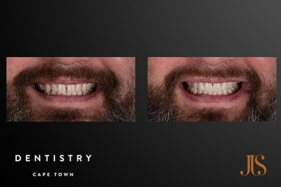 Comprehensive Reconstruction