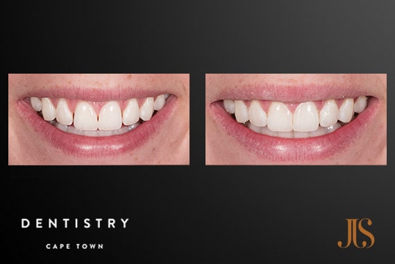 Comprehensive Reconstruction | Dr JJ Serfontein