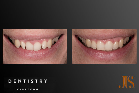 Orthodontics Cape Town