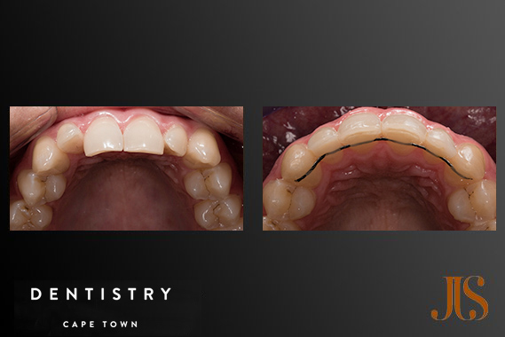 Orthodontist Cape Town