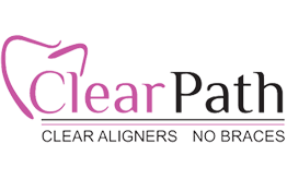 Clear Path Aligners