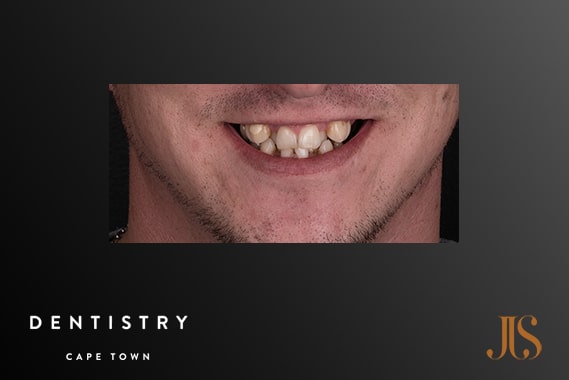 Cosmetic Dentistry Durbanville