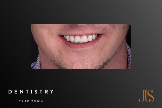 Cosmetic Dentistry Durbanville