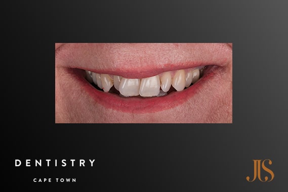 Cosmetic Dentistry Durbanville