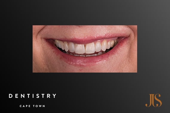 Cosmetic Dentistry Durbanville
