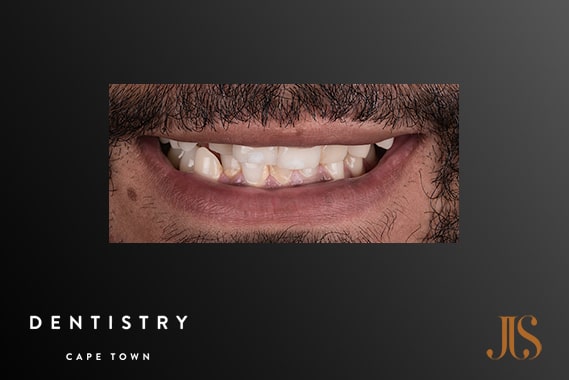 Cosmetic Dentistry Durbanville
