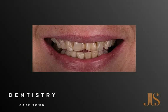 Cosmetic Dentistry Durbanville