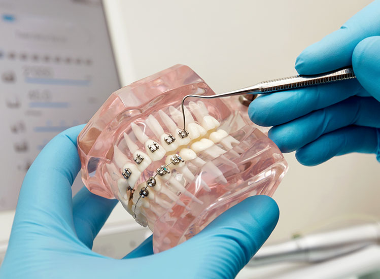 Cosmetic Bridges | Cosmetic Dentist Cape Town