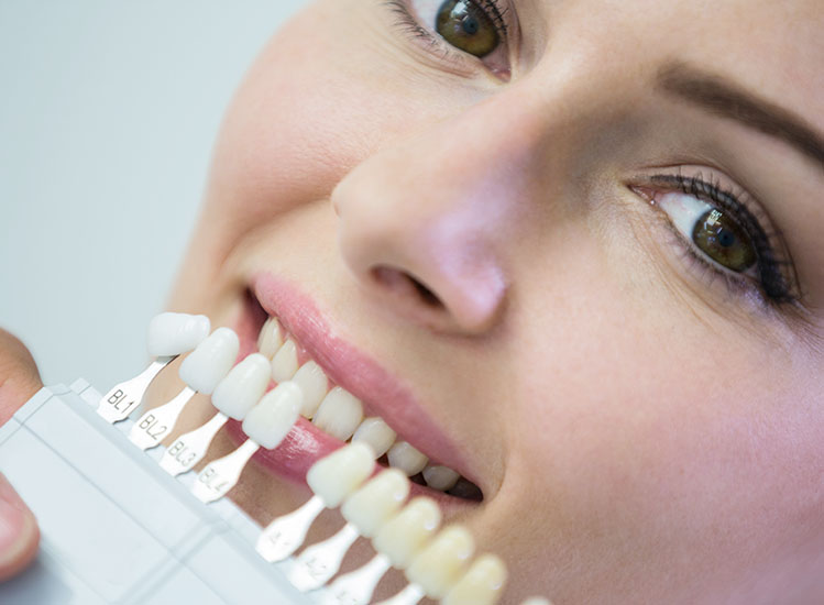 Veneers Cape Town | Dr JJ Serfontein