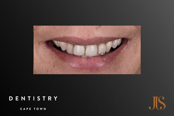 Cosmetic Dentist Durbanville