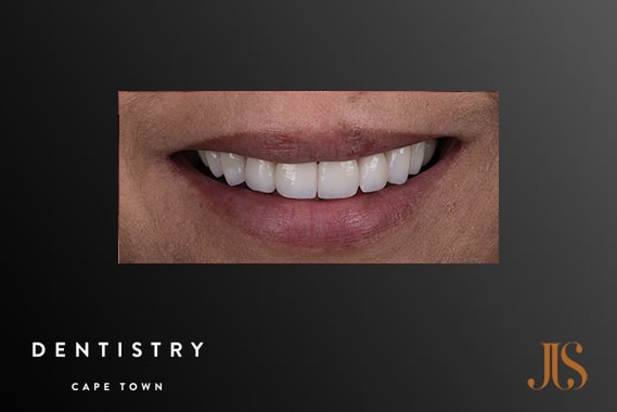 Cosmetic Dentistry Durbanville