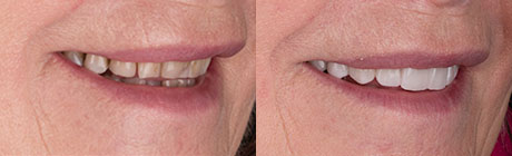 Orthodontics cape town