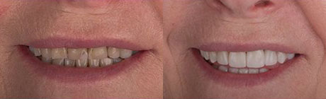 Orthodontics cape town