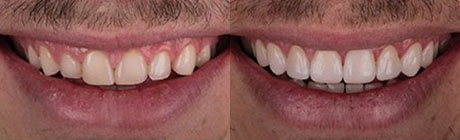 Orthodontics cape town