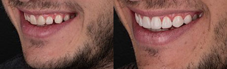 Orthodontics cape town