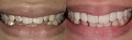 Orthodontics cape town