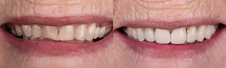 Orthodontics cape town