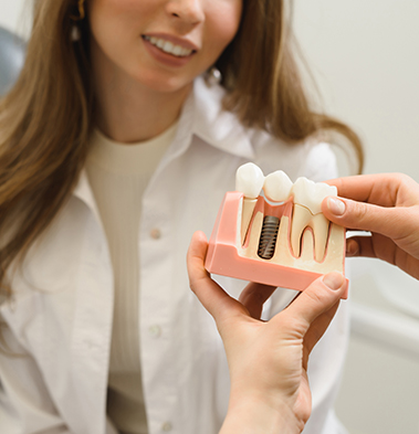 Dental Imlants | Dr JJ Serfontein