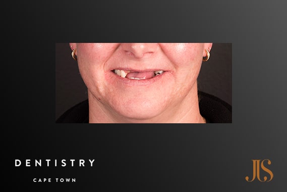 Cosmetic Dentistry Durbanville
