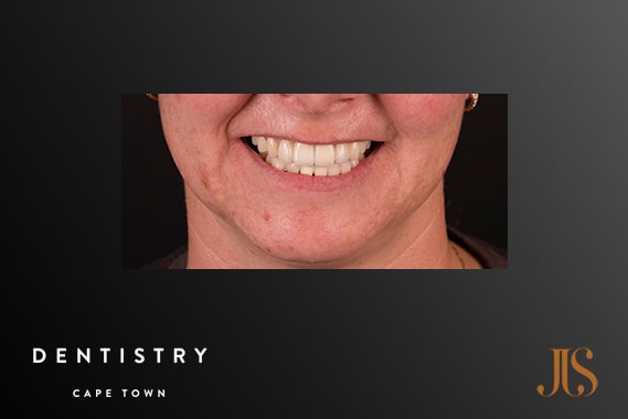 Cosmetic Dentistry Durbanville