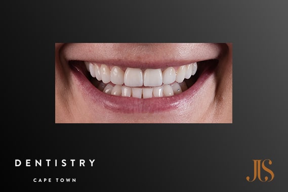 Cosmetic Dentistry Durbanville