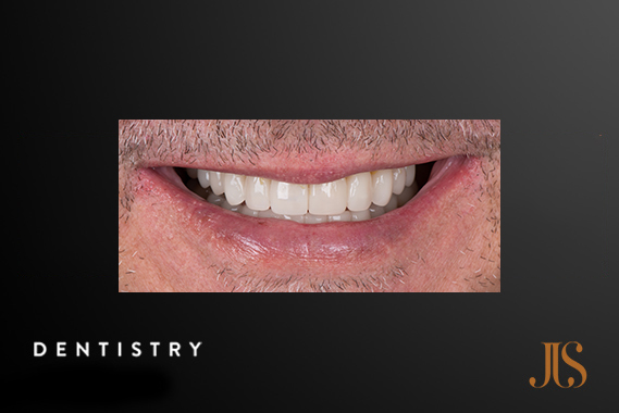 Cosmetic Dentistry Cape Town
