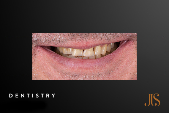 Cosmetic Dentist Cape Town