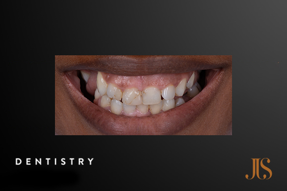 Cosmetic Dentist Cape Town