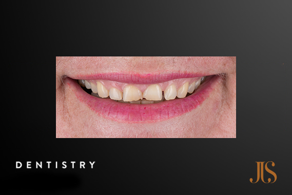 Cosmetic Dentistry Cape Town