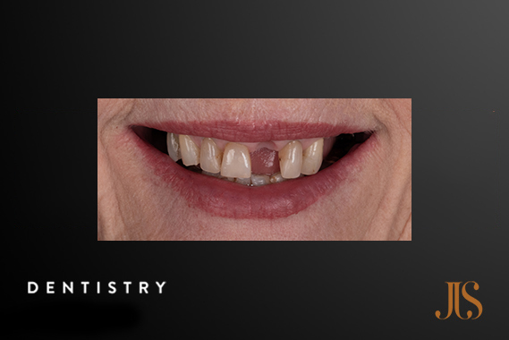 Cosmetic Dentistry Cape Town