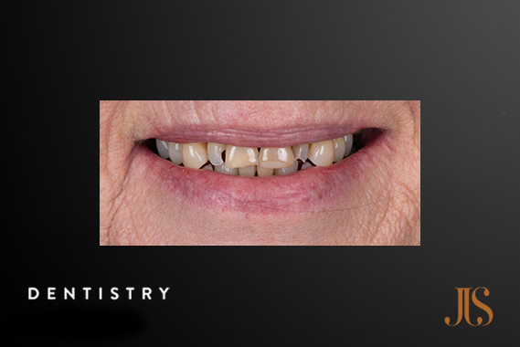 Cosmetic Dentistry Cape Town