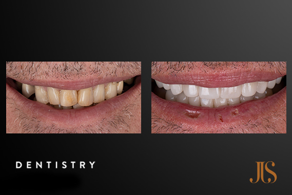 Cosmetic Dentistry