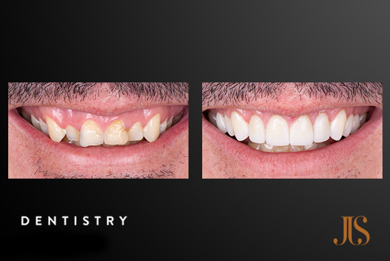 Cosmetic Dentistry