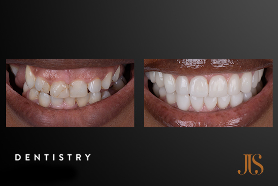 Cosmetic Dentistry
