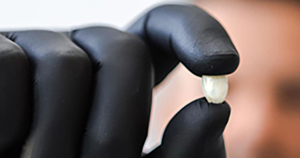 Dental Implants Reconstruction