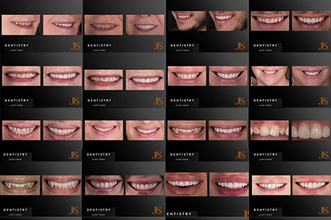 View Our Smile Gallery